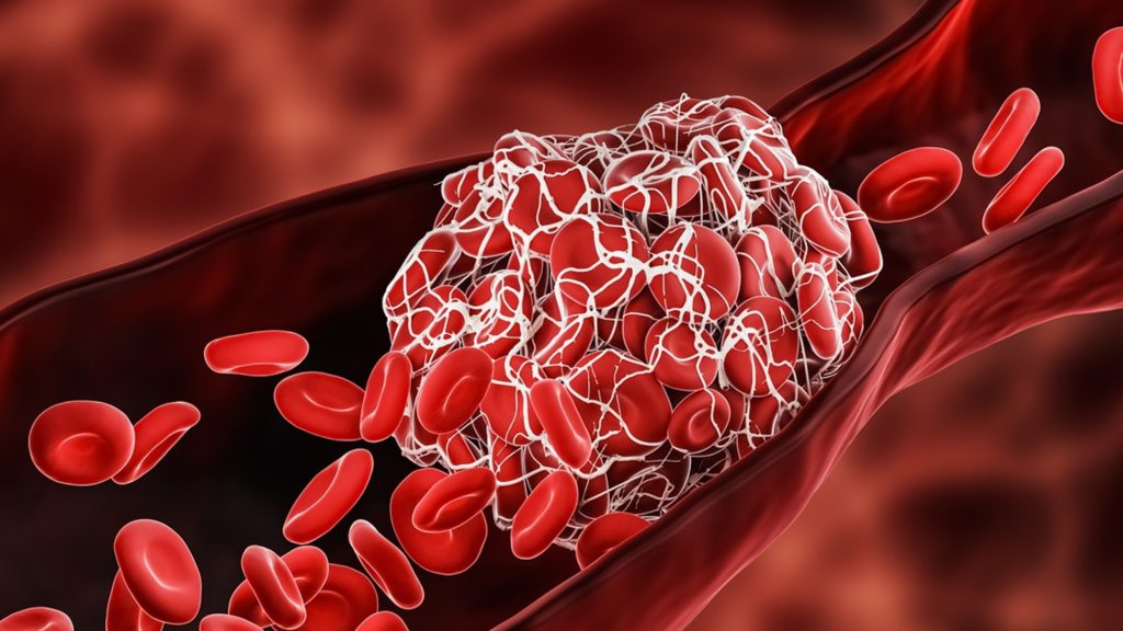 Здравен съвет за деня, 31 октомври: Лекар: Яжте го всеки ден, този зеленчук сваля холестерола и е полезен за съсирването на кръвта Здравен-съвет-за-деня,-31-октомври:-Лекар:-Яжте-го-всеки-ден,-този-зеленчук-сваля-холестерола-и-е-полезен-за-съсирването-на-кръвта